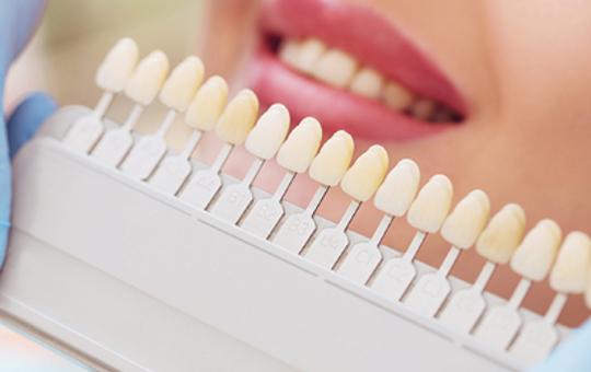 Ceramic Veneers / Metal Free Ceramic Crowns